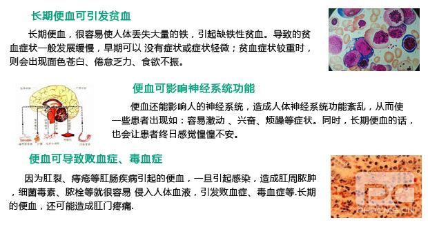 便血的危害,便血